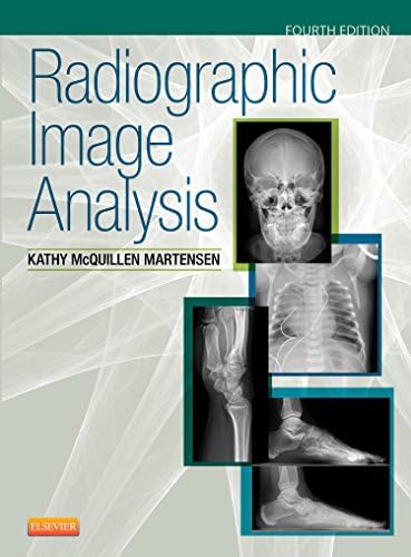 Workbook for Radiographic Image Analysis: 9780323280716: Medicine
